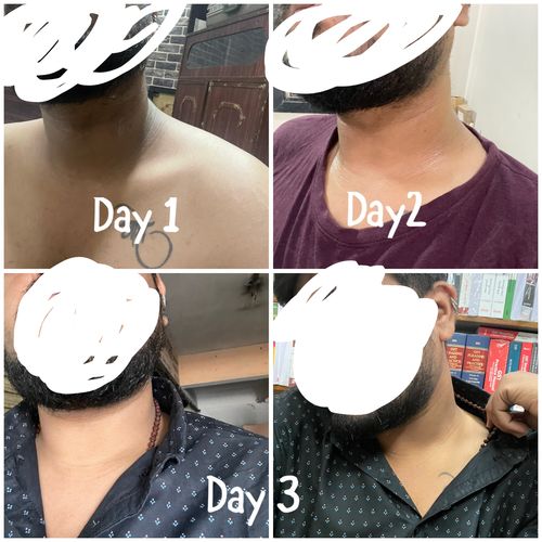 Customer photo review of Nigrifix Cream