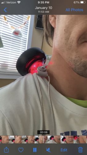 Customer photo review of Achedaway Cupper - The Smart Cupping Therapy Massager