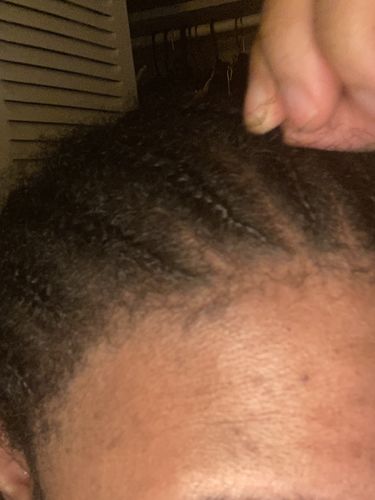 Customer photo review of Herbal Hair Growth Oil