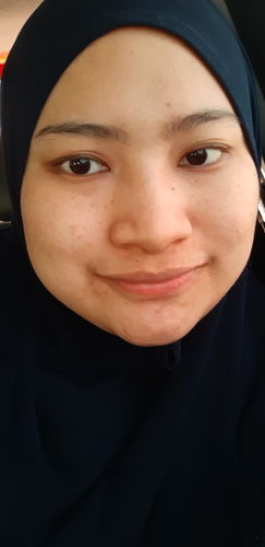 Customer photo review of Triple Action Serum