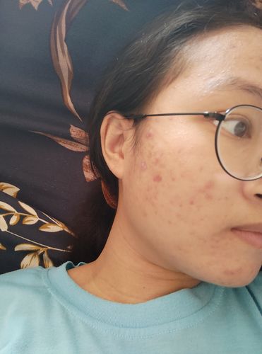 Customer photo review of Brightening Face Creme