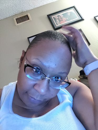 Customer photo review of Herbal Hair Growth Oil