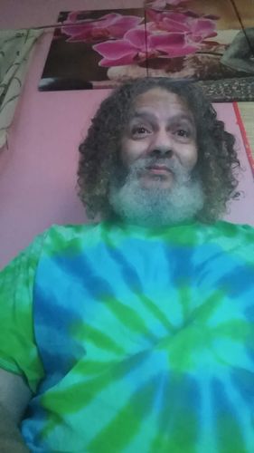 Customer photo review of 12.5% Minoxidil Extra Strength Topical Solution USP for Men.