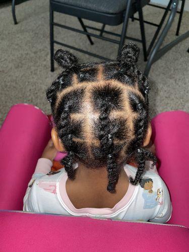 Customer photo review of Kid's Hair Growth Scalp Stimulator