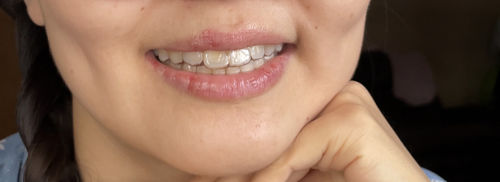 Customer photo review of Extra Impression Putty (STRONGLY RECOMMENDED)