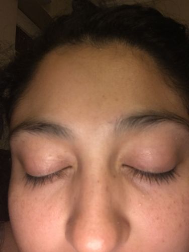 Customer photo review of Lash & Brow Enhancing Serum