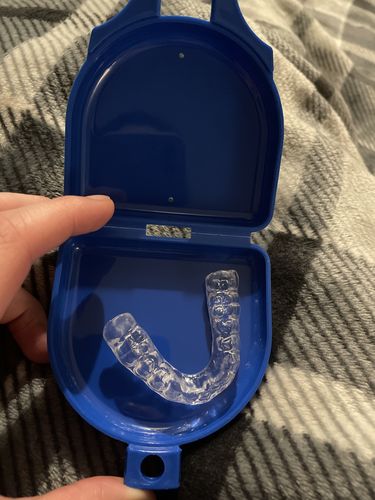 Customer photo review of 14 Day Special Offer