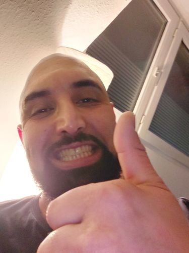 Customer photo review of PAP+ LED Teeth Whitening Kit