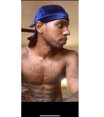 Customer photo review of 12.5% Minoxidil Extra Strength Topical Solution USP for Men.