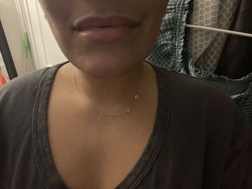 Customer photo review of LipFix: Filler