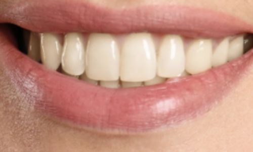 Customer photo review of Pflege- und Whitening Bundle