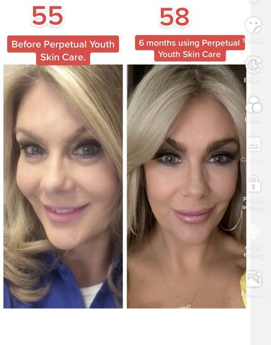 Customer photo review of Growth Factor Serum, Triple Peptide Eye Serum, Exotic Oil (BUNDLE OF 3)