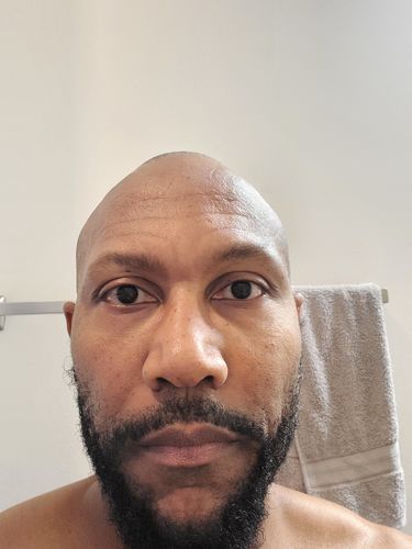 Customer photo review of Herbal Hair/Beard Growth Oil