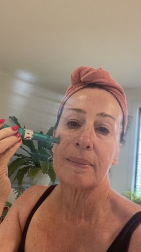 Customer photo review of Dr. Pen Ultima A6S Professional Plus Microneedling Pen