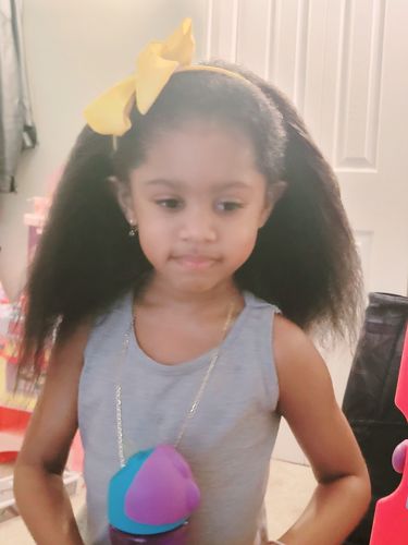 Customer photo review of Kid's Hair Growth Scalp Stimulator