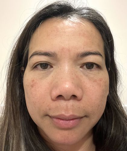 Customer photo review of Dr. Pen M8