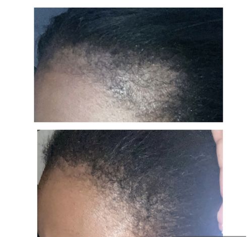 Customer photo review of Inches - Hair & Beard Oil