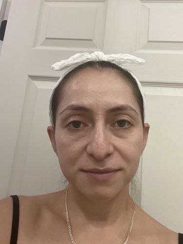 Customer photo review of Juveness Plus Bright Lift