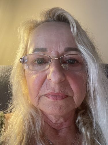 Customer photo review of Dr. Pen Ultima A6 Microneedling Pen