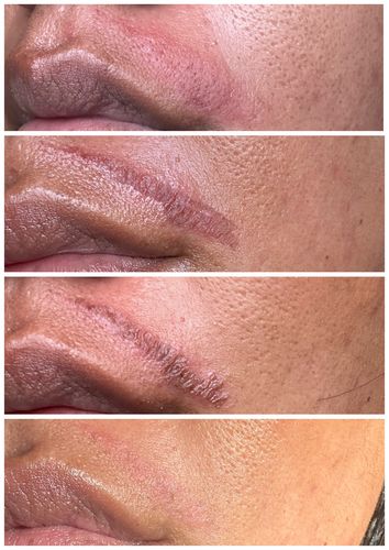Customer photo review of Organic Barrier Balm