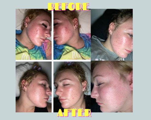 Customer photo review of Clay Mask + FREE Brush