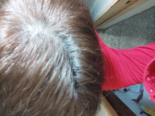 Customer photo review of Loción Anticaída