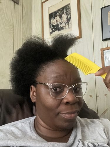 Customer photo review of Growth-Plus Hair Serum