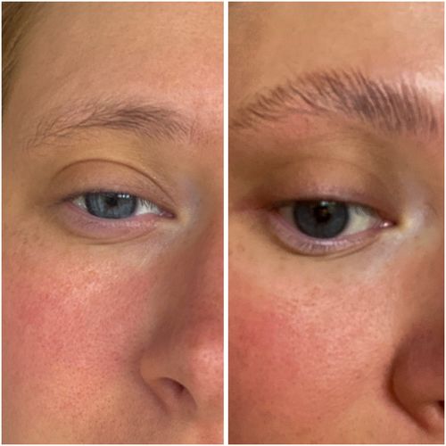 Customer photo review of Brow and lash lamination set "Didier Lab" Esthétique, 3x10 psc.x1,5 ml