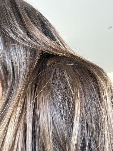 Customer photo review of PACK BOTOX