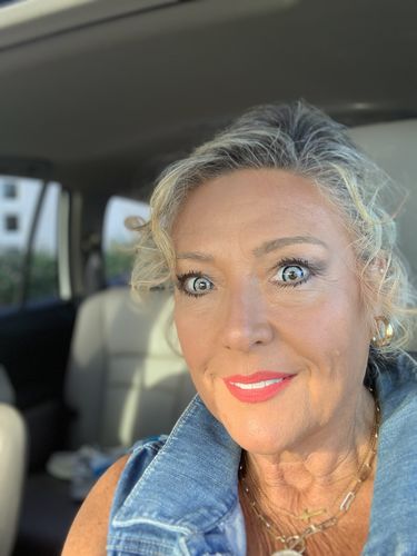 Customer photo review of Automatic Contact Lens Cleaner