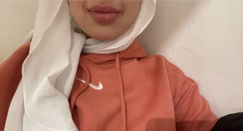 Customer photo review of LipFix: Filler