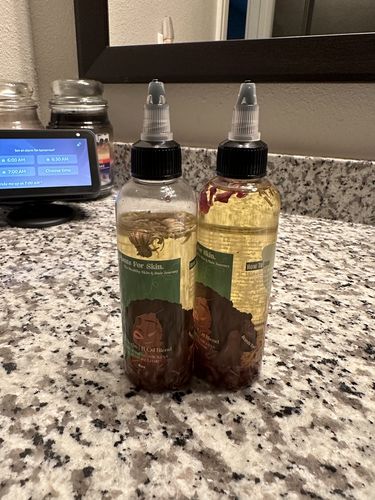 Customer photo review of Herbal Hair/Beard Growth Oil