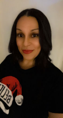 Customer photo review of CheekFix: Filler