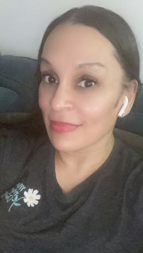 Customer photo review of ChinFix: Filler