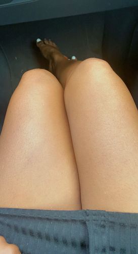 Customer photo review of Extra Intense Brightening Regimen