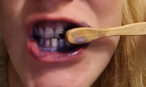 Customer photo review of Whitening Serum