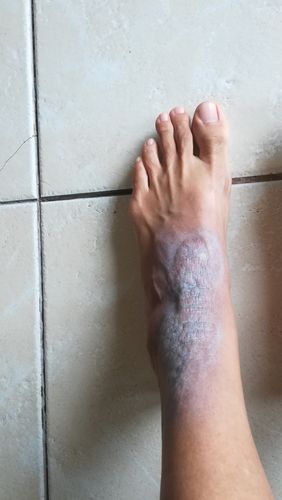 Customer photo review of Healing Balm (35ml)