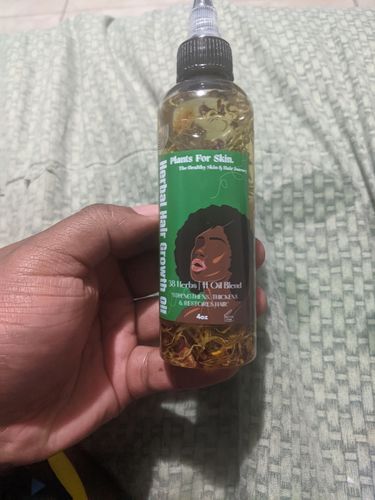 Customer photo review of Herbal Hair/Beard Growth Oil..