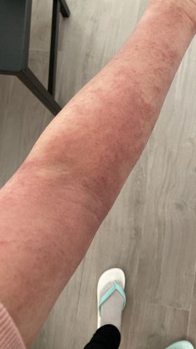 Customer photo review of Coco 濕疹修護霜 80ml