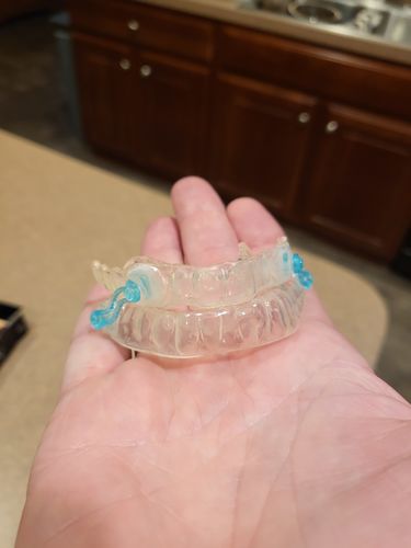 Customer photo review of Sleep Apnea Device