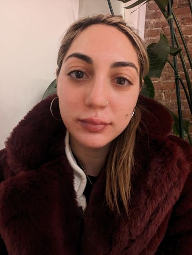 Customer photo review of LipFix: Filler
