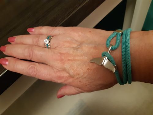 Customer photo review of "Whale" tracking bracelet