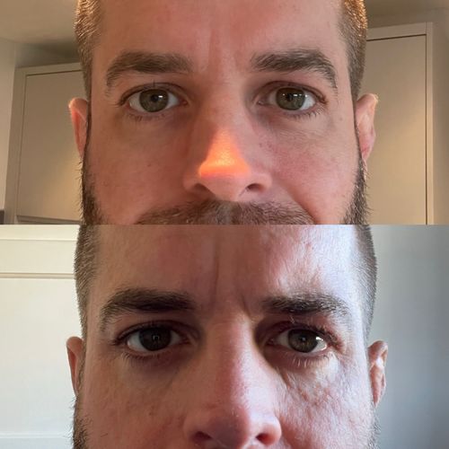 Customer photo review of GRASS-FED TALLOW MOISTURISING CREAM