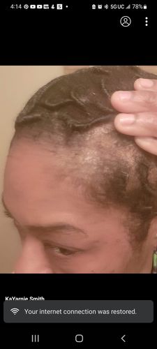 Kayarnie C. review of India’s Secret Ancient Ayurvedic Hair Follicle Elixir (4 sizes) image 1 out of 1