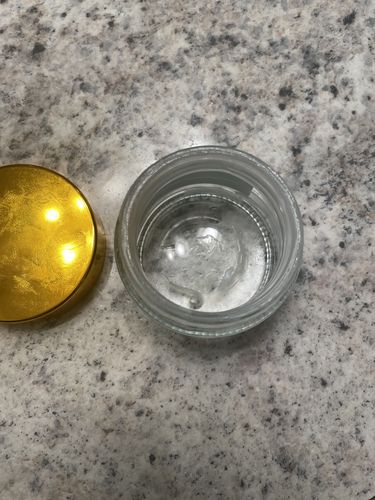 Customer photo review of Intense Discoloration Treatment- Quickly fade unwanted marks such as face, elbow, dark underarms, bikini areas, Melasma, etc(Strong Formula)