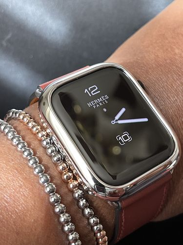Customer photo review of Shiny Open Face Case for the Apple Watch