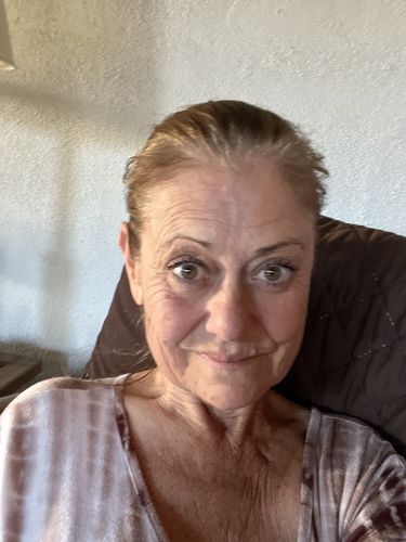 Customer photo review of Self-care Night Recovery Oil