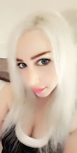 Customer photo review of SL70 Blue Contact Lenses(12 months wear)
