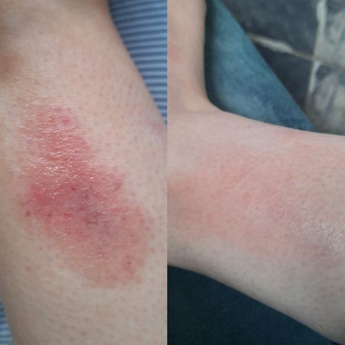 Customer photo review of Soothing Spray