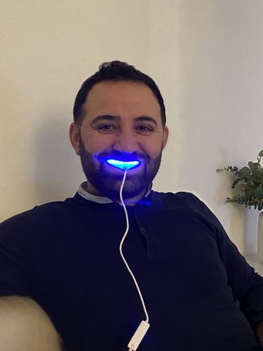 Customer photo review of PAP+ LED Teeth Whitening Kit